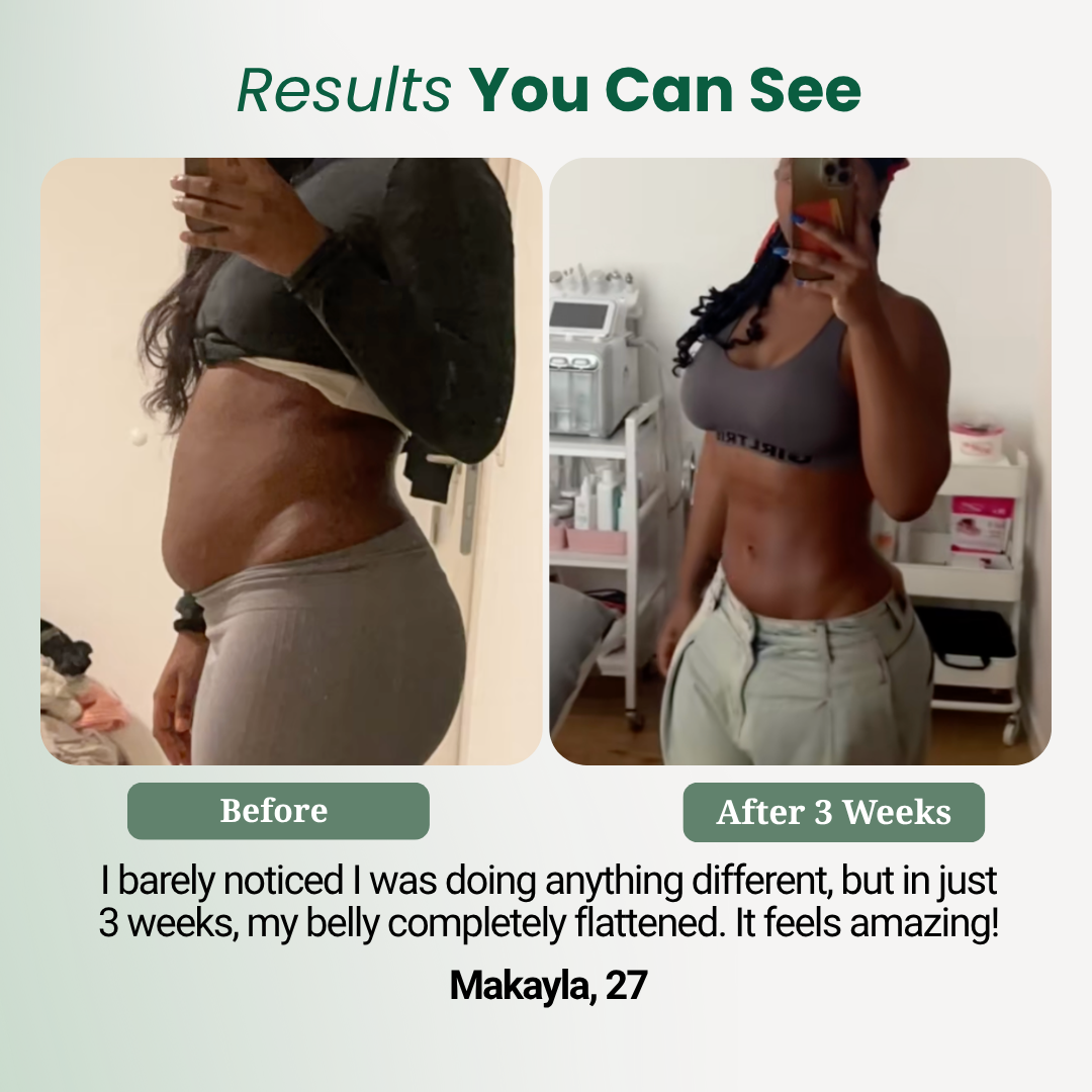 Lymphatic Drainage Drops (30 Servings)